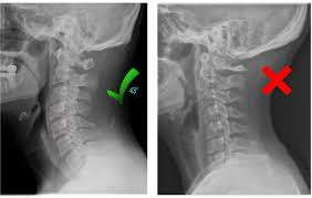Nec X-ray