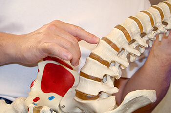 Subluxation